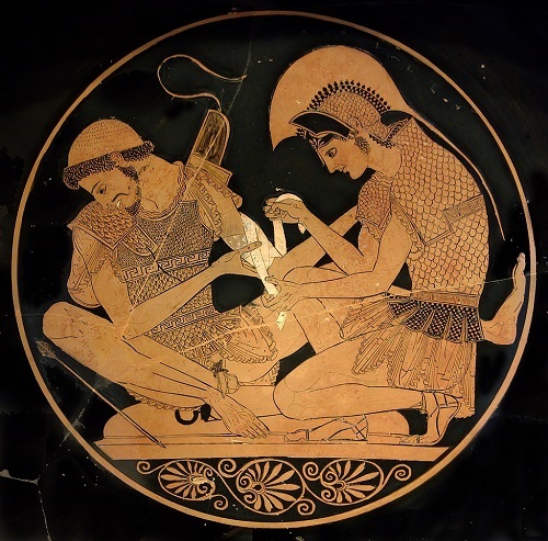 Троянская война. Ахиллес перевязывает Патрокла (такой сцены в «Илиаде» нет, видимо, она из «Киприй»)